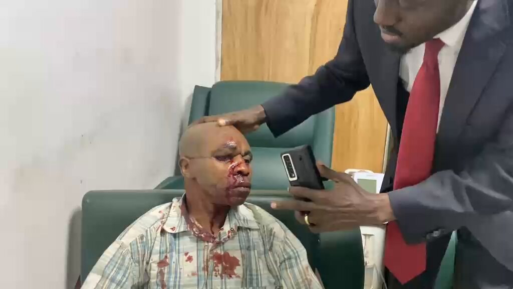 Prince Epenge accuse la Force du Progrès d'avoir attaqué un membre de la C64 lors du cortège de Martin Fayulu article de n...