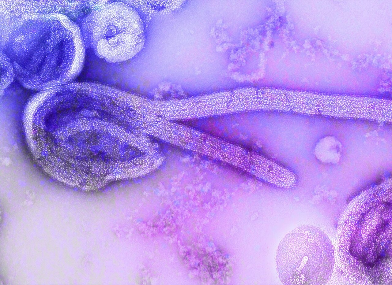 L'épidémie d'Ebola en RDC pourrait devenir une pandémie mondiale article de nouvelles society – Dernier article de nouvelles